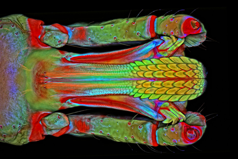Illustration for article titled The Astounding And Horrific World As Seen Under A Microscope